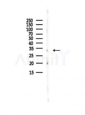 DCYTB Antibody - Western blot analysis of lysates from A375 cells(heat-shock, 45min treatment), using Cytochrome b reductase 1 Antibody at 1/1000 dilution.
