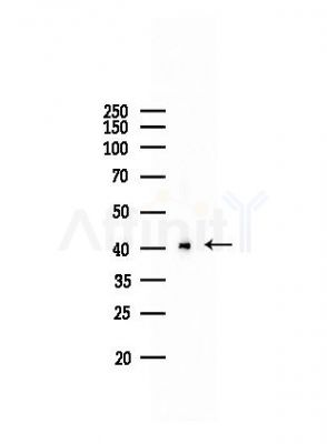 ACAT2 Antibody - Western blot analysis of lysates from Mouse liver, using ACAT2 Antibody at 1/1000 dilution.