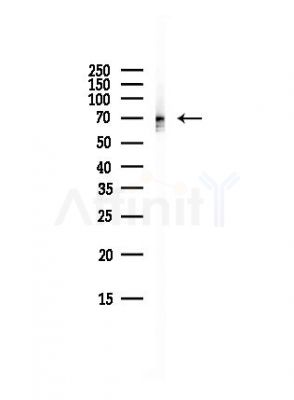 DLAT Antibody - Western blot analysis of lysates from Hela cells(UV, 30min treatment), using DLAT Antibody at 1/1000 dilution.
