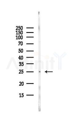 Kallikrein 4 Antibody - Western blot analysis of lysates from HepG2 cells(LPS, 4h treatment), using Kallikrein 4 Antibody at 1/1000 dilution.