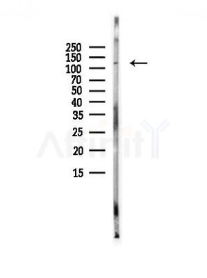 FMNL2 Antibody - Western blot analysis of lysates from A375 cells(heat-shock, 45min treatment), using FMNL2 Antibody at 1/1000 dilution.