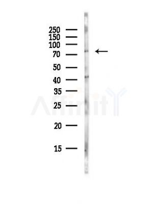 CPSF73 Antibody - Western blot analysis of lysates from Hela cells(UV, 30min treatment), using CPSF73 Antibody at 1/1000 dilution.