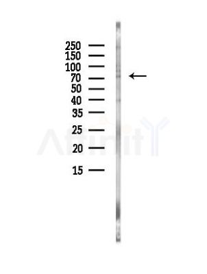 CPSF73 Antibody - Western blot analysis of lysates from A375 cells(heat-shock, 45min treatment), using CPSF73 Antibody at 1/1000 dilution.