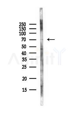 CoREST3/RCOR3 Antibody - Western blot analysis of lysates from HepG2 cells(LPS, 4h treatment), using CoREST3/RCOR3 Antibody at 1/1000 dilution.