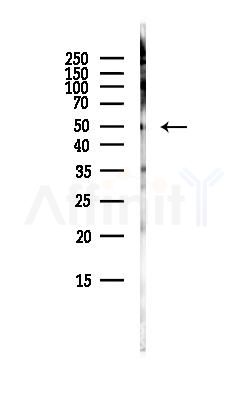 Testin Antibody - Western blot analysis of lysates from PC12 cells(starvation, 24h treatment), using Testin Antibody at 1/1000 dilution.