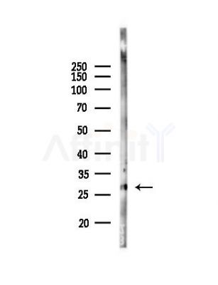 TACI Antibody - Western blot analysis of lysates from Mouse liver, using TACI Antibody at 1/1000 dilution.