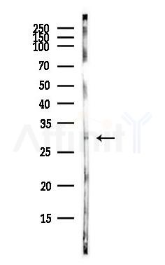 CLEC9A Antibody - Western blot analysis of lysates from COLO205 cells(heat-shock,45min treatment), using CLEC9A Antibody at 1/1000 dilution.