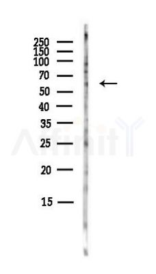ZNF312B Antibody - Western blot analysis of lysates from A375 cells(heat-shock,45min treatment), using ZNF312B Antibody at 1/1000 dilution.