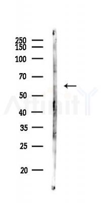 ZNF312B Antibody - Western blot analysis of lysates from Mouse liver, using ZNF312B Antibody at 1/1000 dilution.