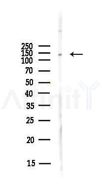 PFAS Antibody - Western blot analysis of lysates from A375 cells(heat-shock,45min treatment), using PFAS Antibody at 1/1000 dilution.
