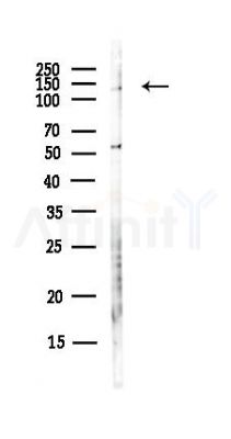 PFAS Antibody - Western blot analysis of lysates from Hela cells(UV, 30min treatment), using PFAS Antibody at 1/1000 dilution.