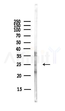TUSC1 Antibody - Western blot analysis of lysates from A375 cells(heat-shock,45min treatment), using TUSC1 Antibody at 1/1000 dilution.