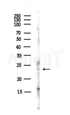 TUSC1 Antibody - Western blot analysis of lysates from Hela cells(UV, 30min treatment), using TUSC1 Antibody at 1/1000 dilution.
