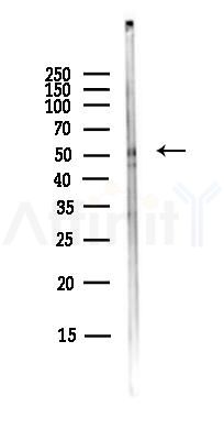 TRIM72 Antibody - Western blot analysis of lysates from A375 cells(heat-shock,45min treatment), using TRIM72 Antibody at 1/1000 dilution.
