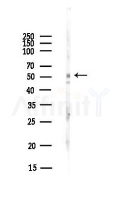 TRIM72 Antibody - Western blot analysis of lysates from Hela cells(UV, 30min treatment), using TRIM72 Antibody at 1/1000 dilution.