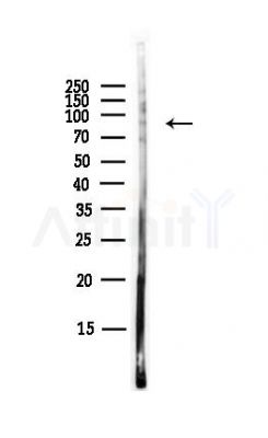 RNF43 Antibody - Western blot analysis of lysates from A375 cells(heat-shock,45min treatment), using RNF43 Antibody at 1/1000 dilution.