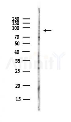 RNF43 Antibody - Western blot analysis of lysates from Hela cells(UV, 30min treatment), using RNF43 Antibody at 1/1000 dilution.