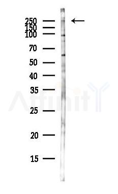 CHD3 Antibody - Western blot analysis of lysates from COLO205 cells(heat-shock,45min treatment), using CHD3 Antibody at 1/1000 dilution.