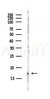 BTG2 Antibody - Western blot analysis of lysates from Hela cells(UV, 30min treatment), using BTG2 Antibody at 1/1000 dilution.