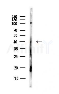 Sprouty 2 Antibody - Western blot analysis of lysates from Hela cells(UV, 30min treatment), using Sprouty 2 Antibody at 1/1000 dilution.