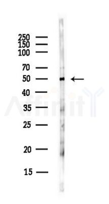 NUP50 Antibody - Western blot analysis of lysates from Hela cells(UV, 30min treatment), using NUP50 Antibody at 1/1000 dilution.