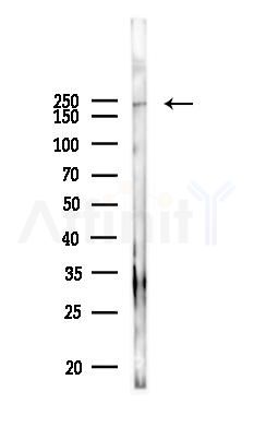ch TOG Antibody - Western blot analysis of lysates from PC12 cells, using ch TOG Antibody at 1/1000 dilution.