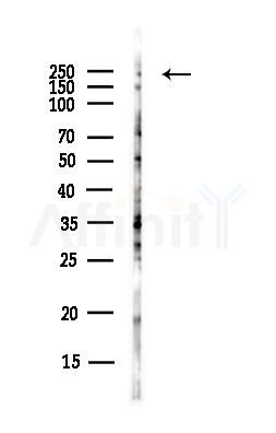 ch TOG Antibody - Western blot analysis of lysates from Hela cells(UV, 30min treatment), using ch TOG Antibody at 1/1000 dilution.