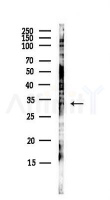 DNALI1 Antibody - Western blot analysis of lysates from Hela cells(UV, 30min treatment), using DNALI1 Antibody at 1/1000 dilution.