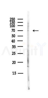 TRAK1 Antibody - Western blot analysis of lysates from A375 cells(heat-shock,45min treatment), using TRAK1 Antibody at 1/1000 dilution.