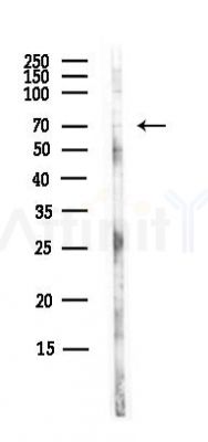 TRAK1 Antibody - Western blot analysis of lysates from Hela cells(UV, 30min treatment), using TRAK1 Antibody at 1/1000 dilution.