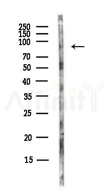 ZFYVE1 Antibody - Western blot analysis of lysates from Hela cells(UV, 30min treatment), using ZFYVE1 Antibody at 1/1000 dilution.