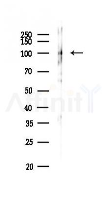ZFR Antibody - Western blot analysis of lysates from Mouse liver, using ZFR Antibody at 1/1000 dilution.