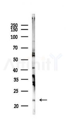 MARVELD1 Antibody - Western blot analysis of lysates from Mouse liver, using MARVELD1 Antibody at 1/1000 dilution.