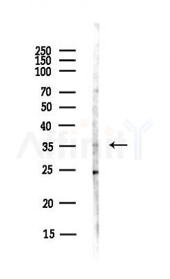 delta Sarcoglycan Antibody - Western blot analysis of lysates from Hela cells(UV, 30min treatment), using delta Sarcoglycan Antibody at 1/1000 dilution.