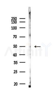 Tbx20 Antibody - Western blot analysis of lysates from Mouse liver, using Tbx20 Antibody at 1/1000 dilution.