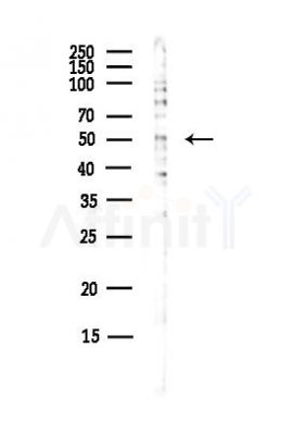 Tbx20 Antibody - Western blot analysis of lysates from Hela cells(UV, 30min treatment), using Tbx20 Antibody at 1/1000 dilution.
