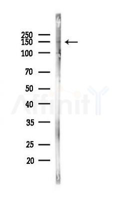 SLC12A3 Antibody - Western blot analysis of lysates from PC12 cells, using SLC12A3 Antibody at 1/1000 dilution.