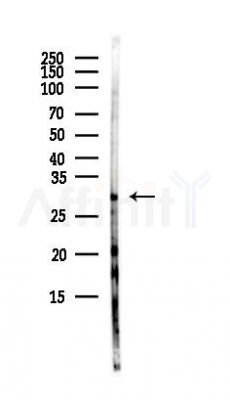 MMACHC Antibody - Western blot analysis of lysates from COLO205 cells(heat-shock,45min treatment), using MMACHC Antibody at 1/1000 dilution.