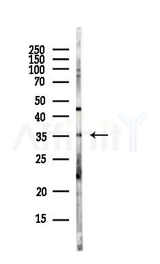 MMACHC Antibody - Western blot analysis of lysates from MCF7 cells(heat-shock,45min treatment), using MMACHC Antibody at 1/1000 dilution.