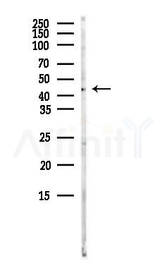 PSCDBP Antibody - Western blot analysis of lysates from COLO205 cells(heat-shock,45min treatment), using PSCDBP Antibody at 1/1000 dilution.