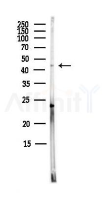 PSCDBP Antibody - Western blot analysis of lysates from MCF7 cells(heat-shock,45min treatment), using PSCDBP Antibody at 1/1000 dilution.