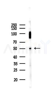 FBXL3 Antibody - Western blot analysis of lysates from Mouse liver, using FBXL3 Antibody at 1/1000 dilution.