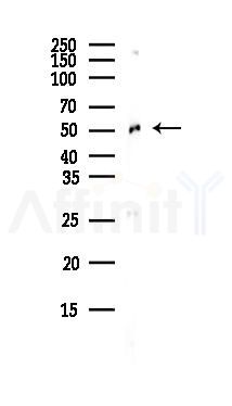 FBXL3 Antibody - Western blot analysis of lysates from COLO205 cells(heat-shock,45min treatment), using FBXL3 Antibody at 1/1000 dilution.