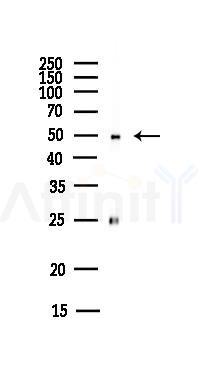 FBXL3 Antibody - Western blot analysis of lysates from MCF7 cells(heat-shock,45min treatment), using FBXL3 Antibody at 1/1000 dilution.