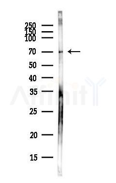 CMG1 Antibody - Western blot analysis of lysates from COLO205 cells(heat-shock,45min treatment), using CMG1 Antibody at 1/1000 dilution.