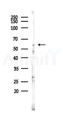 Coatomer subunit delta Antibody - Western blot analysis of lysates from PC12 cells, using Coatomer subunit delta Antibody at 1/1000 dilution.