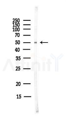 Nova1 Antibody - Western blot analysis of lysates from MCF7 cells(heat-shock,45min treatment), using Nova1 Antibody at 1/1000 dilution.