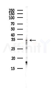 C9orf78 Antibody - Western blot analysis of lysates from COLO205 cells(heat-shock,45min treatment), using C9orf78 Antibody at 1/1000 dilution.
