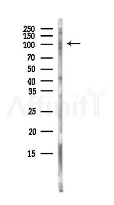 ITIH3 Antibody - Western blot analysis of lysates from COLO205 cells(heat-shock,45min treatment), using ITIH3 Antibody at 1/1000 dilution.