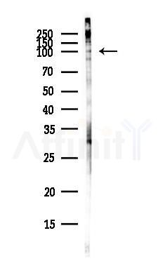 C16orf62 Antibody - Western blot analysis of lysates from COLO205 cells(heat-shock,45min treatment), using C16orf62 Antibody at 1/1000 dilution.